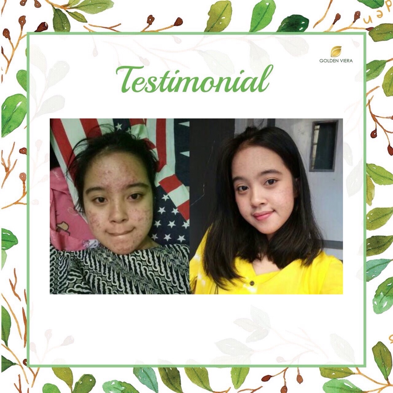 Foto testimoni D***