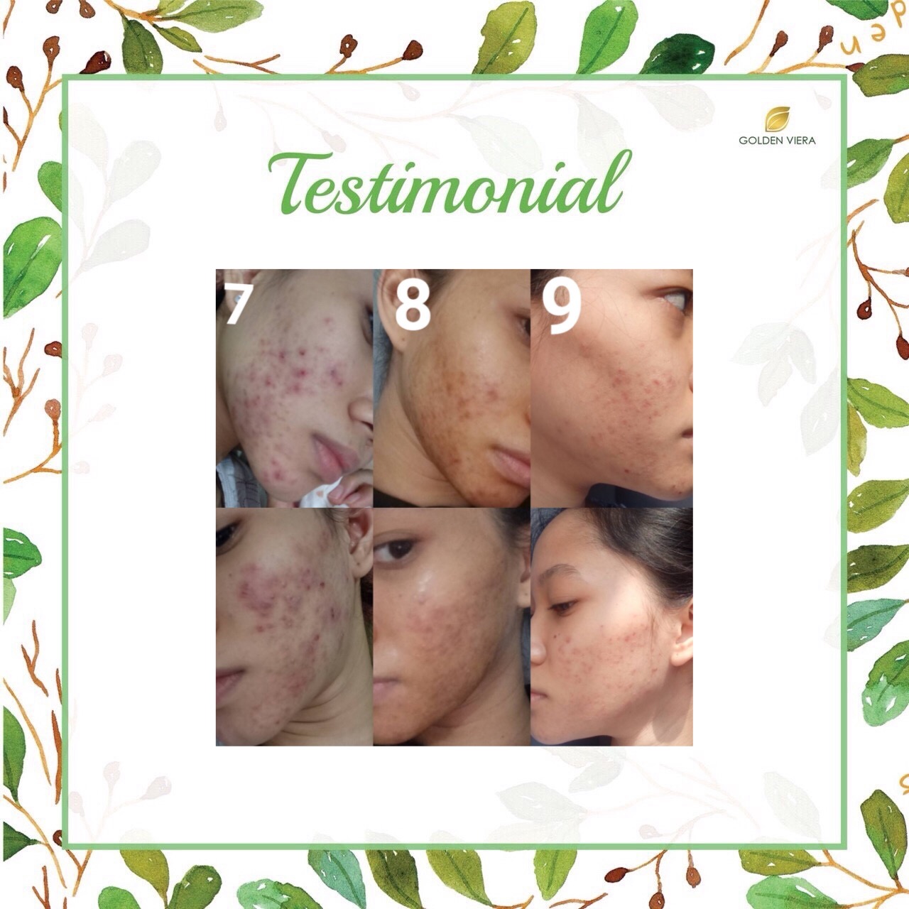 Foto testimoni A****A