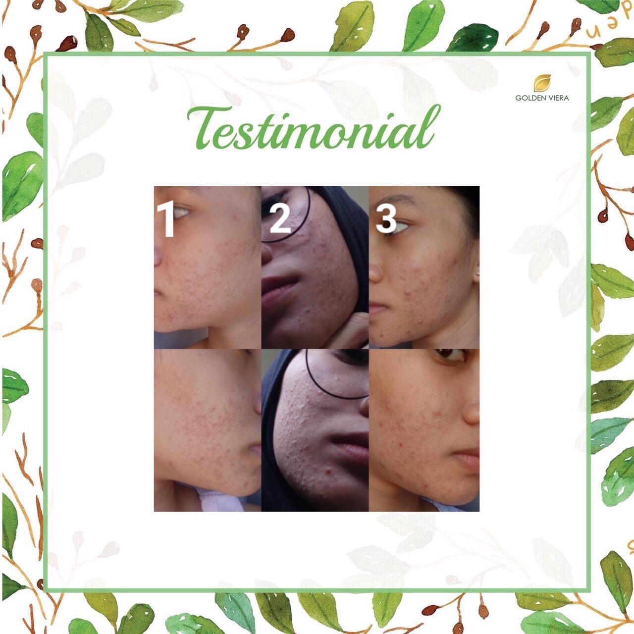 Foto testimoni A****A